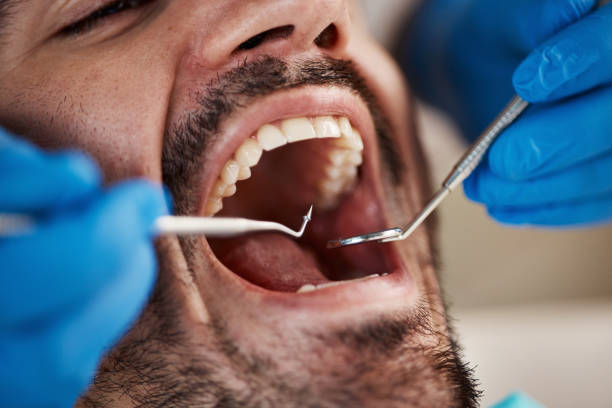 Best Emergency Dentist for Knocked-Out Tooth in Schlusser, PA